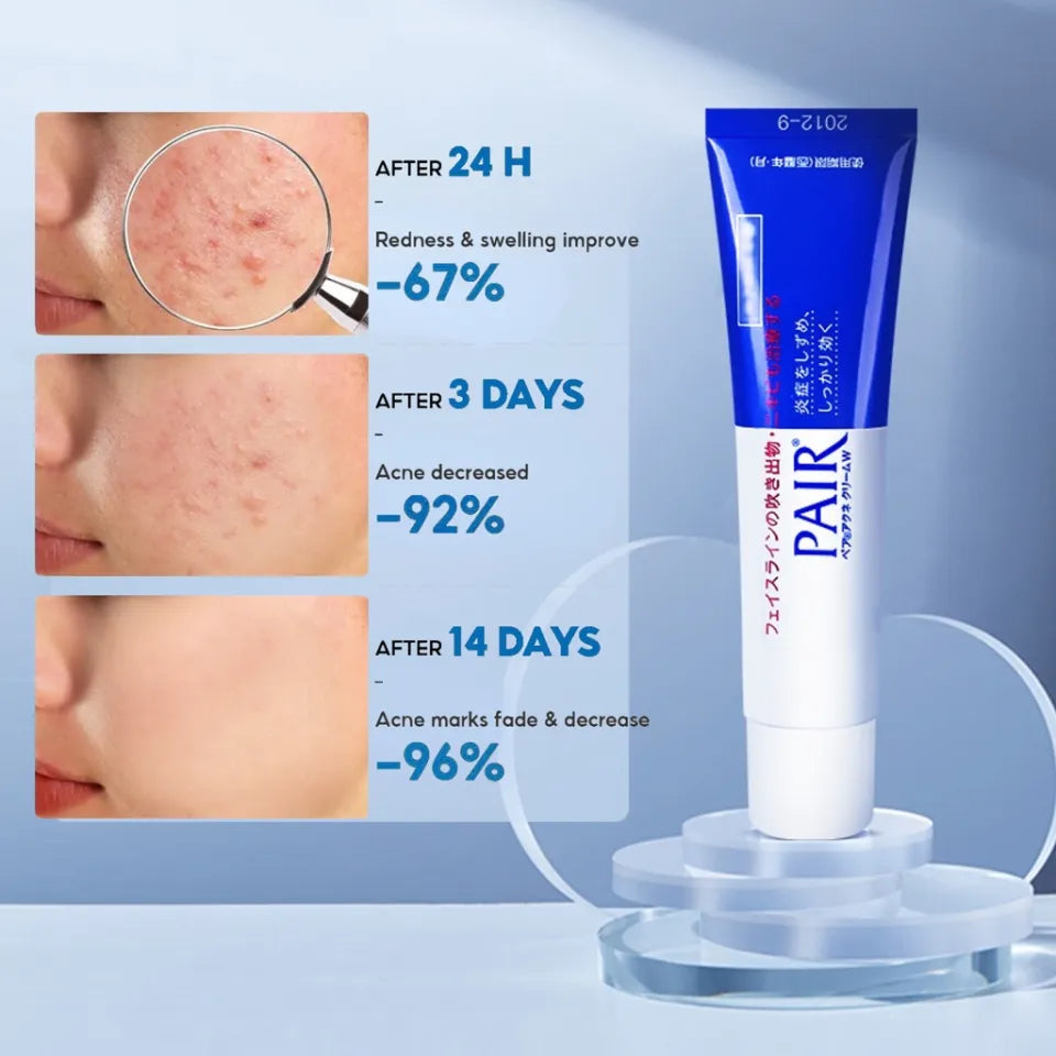 Lion Pair Acne Cream 14gm